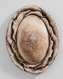 Breast 3