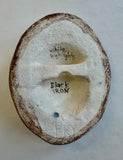 Breast 3